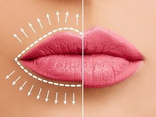 LABIOS IRRESISTIBLES, MÁS LINDOS, MÁS DEFINIDOS, PERO SUPER NATURALES