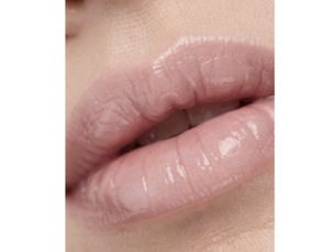 Armonización facial, aumento de labios