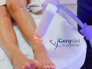 Deplilación láser con un 50% de descuento