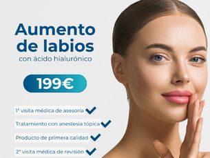 199€ solo este mes