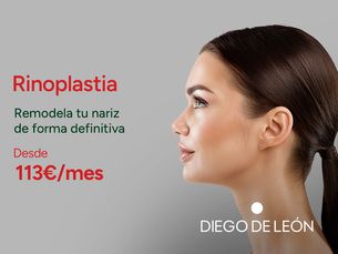 ¡¡RINOPLASTIA!!