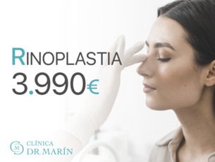 Madrid - Rinoplastia 3.990€, todo incluido