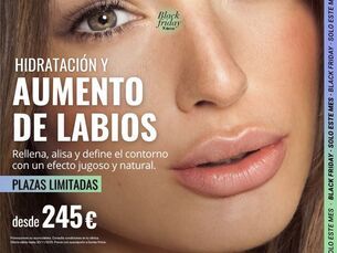HIDRATACIÓN Y AUMENTO DE LABIOS DESDE 245€