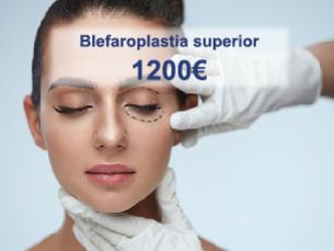 Blefaroplastia superior por sólo 1200€