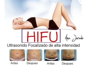 149€ Sesión suelta de HIFU corporal