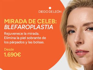MIRADA DE CELEB