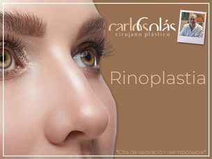 ¡¡Rinoplastia!!