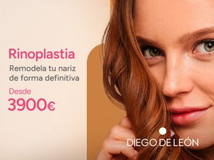 DISEÑO DE NARIZ: RINOPLASTIA