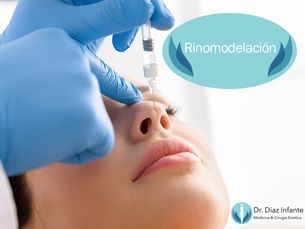 Mejoría estética de la nariz sin cirugía