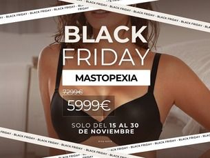 MASTOPEXIA CON IMPLANTES