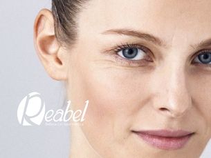 Blefaroplastia sin Cirugía en Las Rozas | Rejuvenecimiento de Párpados