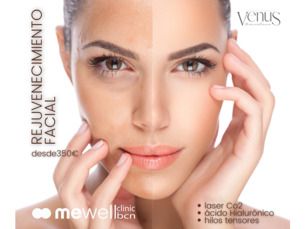 Rejuvenecimiento facial por 350€