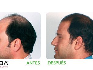 Tratamiento capilar unisex