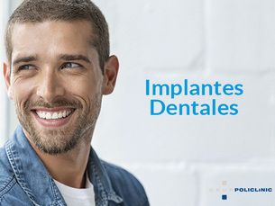 Implantes dentales con descuento