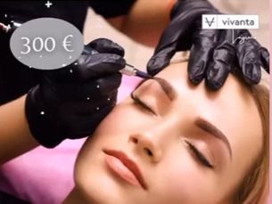 Tratmiento de Microblanding por 300€