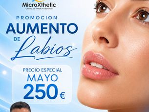 PROMO MAYO AUMENTO DE LABIOS 250€
