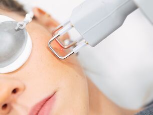 Resurfacing láser CO₂ facial