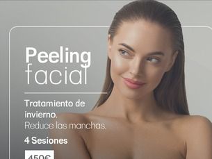 Peeling Facial - 4 sesiones 450€