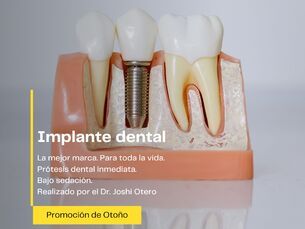 Implantes dentales para casos complejos. Sin dolor.  Máximas garantías