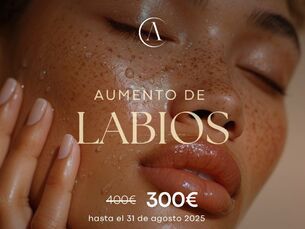 AUMENTOS DE LABIOS
