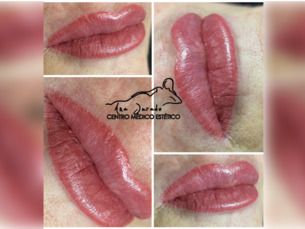 Oferta especial micropigmentación de labios