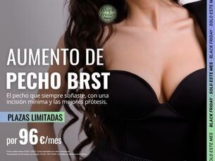 AUMENTO DE PECHO POR SÓLO 96€/MES