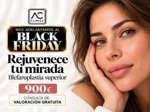 Blefaroplastia superior