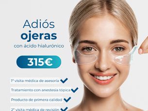 315€ solo este mes