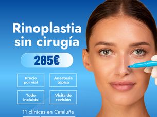 Rinomodelación: 285€