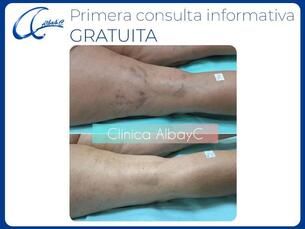 Primera consulta valorativa gratuita para todos los tratamientos