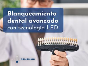 Blanqueamiento dental avanzado con tecnología LED