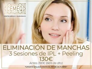Eliminación de Manchas