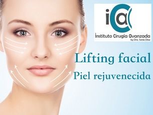 Lifting facial para el paso de los años y estar siempre fantástica