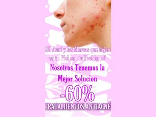 Dile adiós a tu acné y a tus manchas faciales al 60%