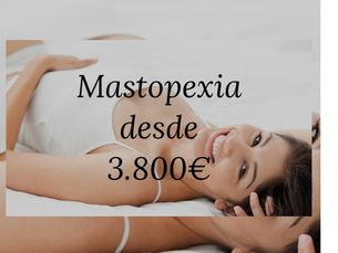 Mastopexia o elevación de pecho 3.800 euros