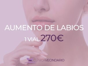 Aumento de labios por solo 270€