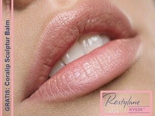 Los labios que siempre has deseado: restylane kysse