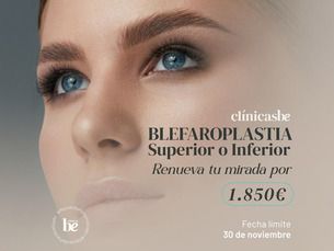 Blefaroplastia superior e inferior