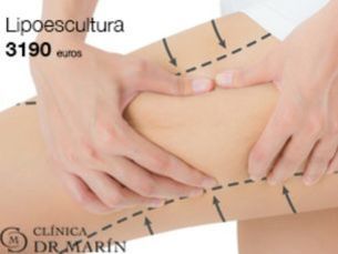 Madrid - Lipoescultura 3190€
