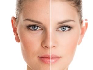 Piel radiante + tratamiento rejuvenecedor por 130€ (Antes 180€)