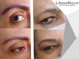 Micropigmentación Cejas 250€