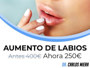 Aumento de labios por solo 250€