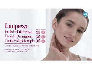 Limpieza facial profunda Antes 130€ Ahora 99€