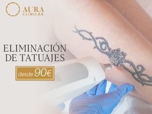 Eliminación de tatuajes