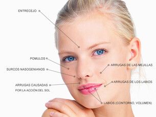 ¡Comienza el año sin arrugas! Acido hialuronico 35% decuento, Botox 100€