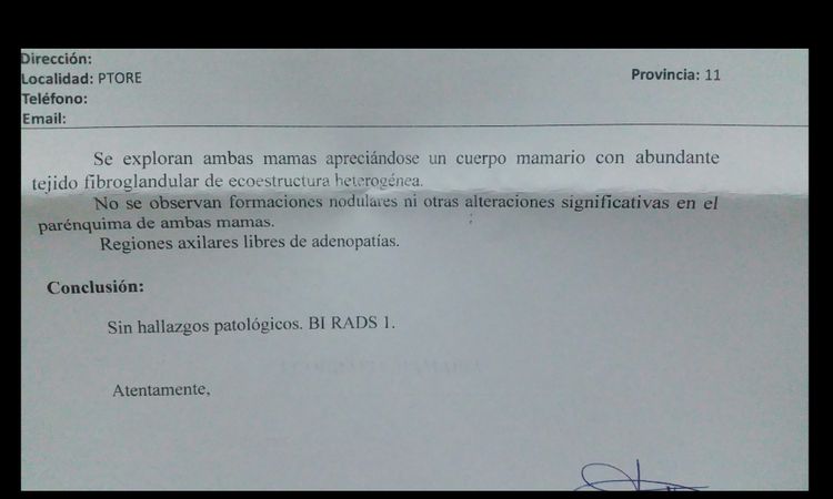 ¿Se me notará los implantes al tacto? - 3823