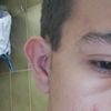 Elimar ojera desde el ojo hasta el pómulo - 5672