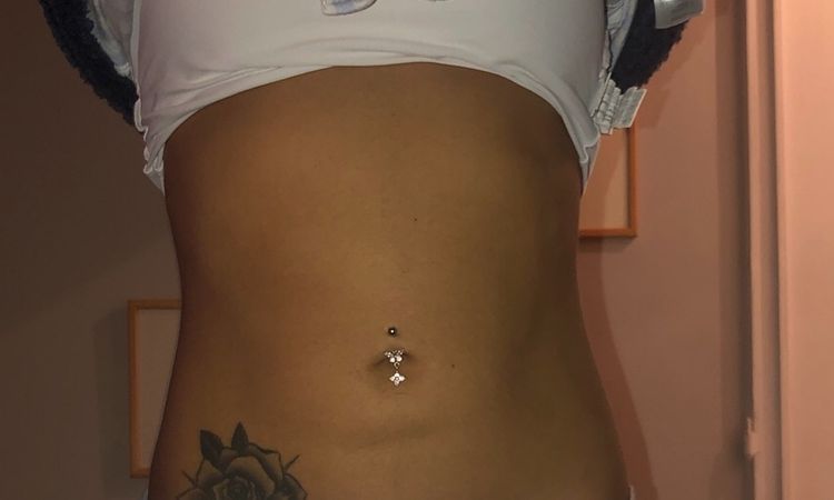 Tercera liposuccion, cuál serían los riesgos? Es posible ? - 6052