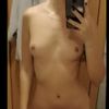 ¿Qué tipo de prótesis y qué tamaño me recomendáis?