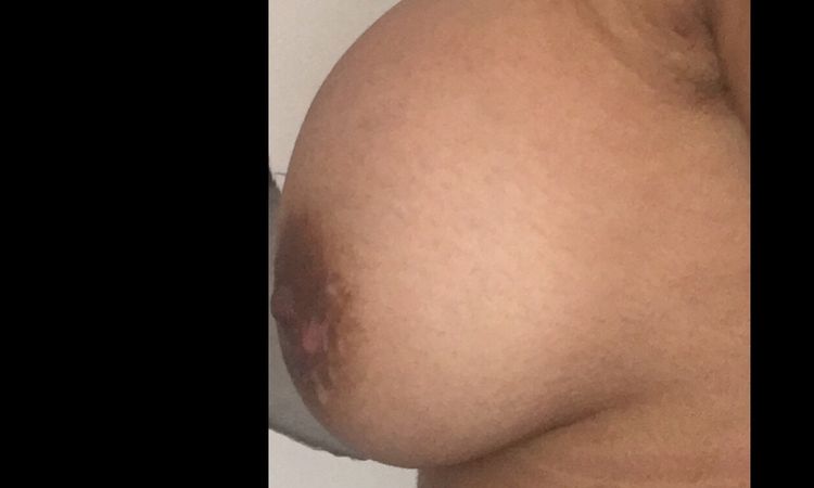 Prótesis alta y seno caido - 6929